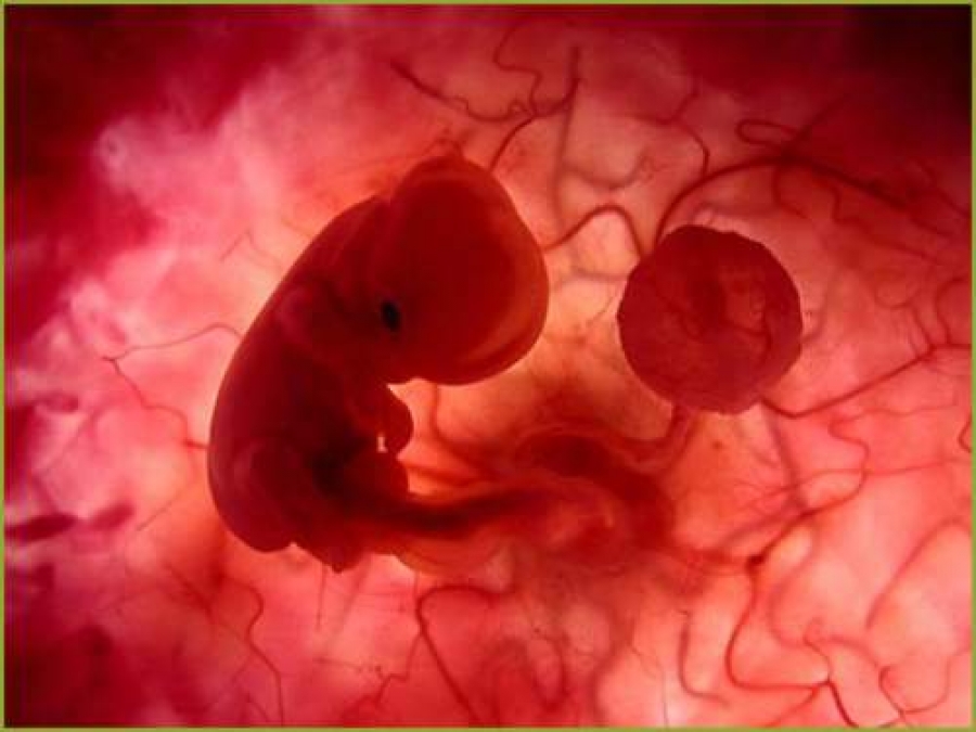 Polemica sull’aborto, Scienza&#038;Vita risponde alla CGIL 1