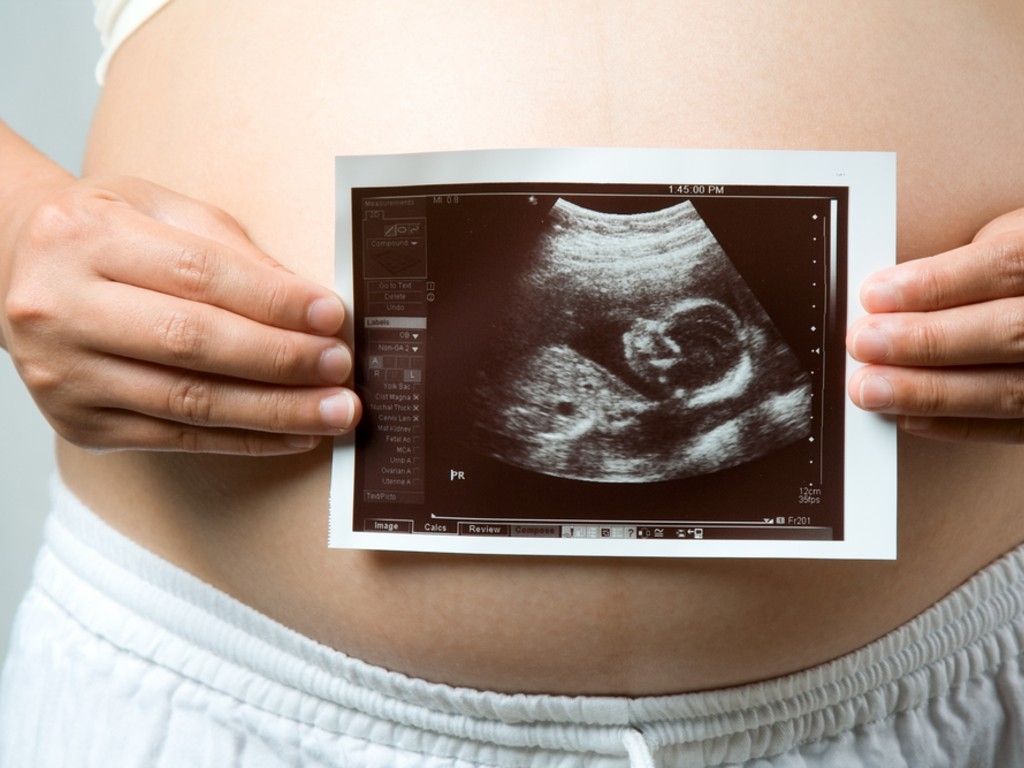 Aborto, l’eterno tabù  che lacera la coscienza cattolica 1